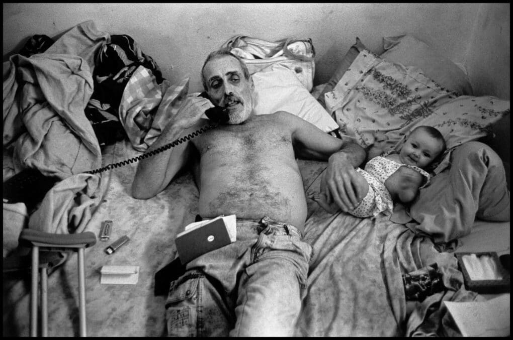 Man with not shirt and beard is leaning back in his bed, talking on a rotary telephone, with his other hand resting on a baby that's about 6 months old. There is a pair of crutches and a cigarette lighter visible.